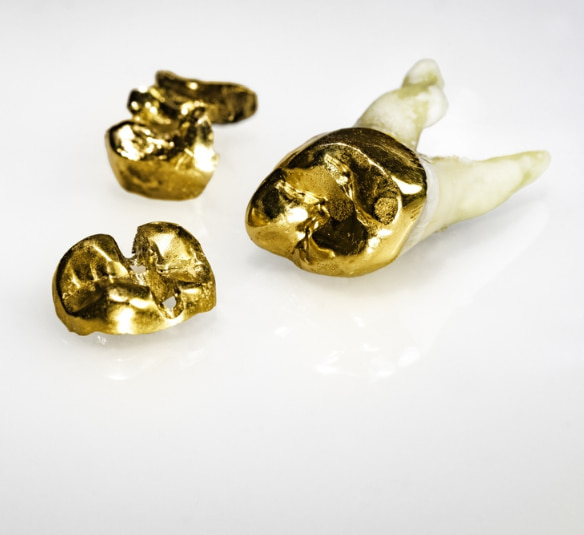 importancia de la compraventa de dientes de oro