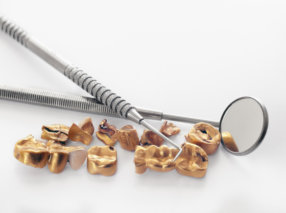 vender dientes de oro